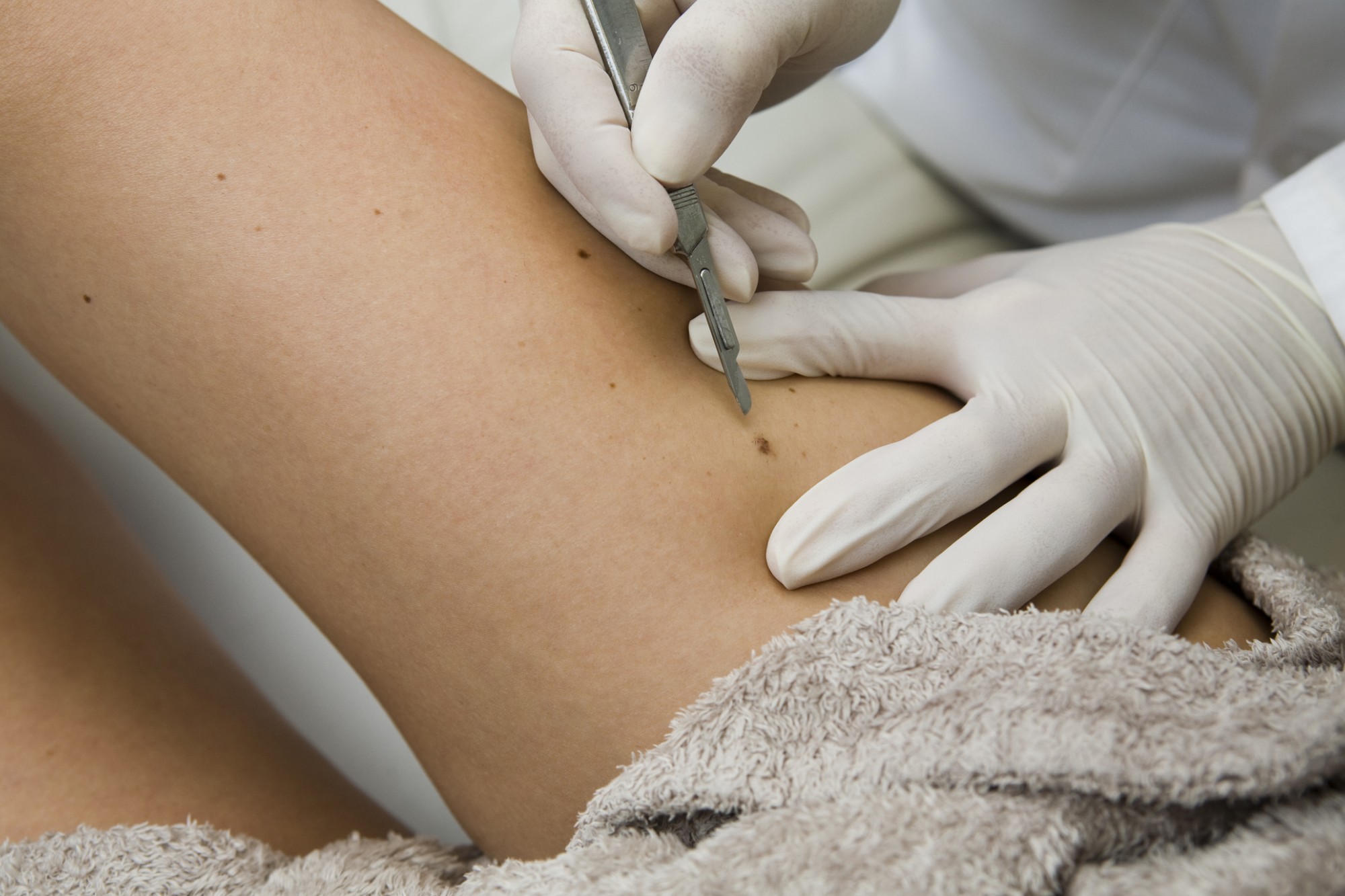 5 Skin Conditions You Can Treat With Laser Therapy