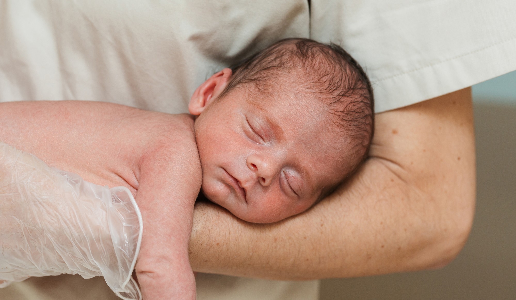Debunking 5 Common Myths About Newborn Rashes